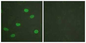 Lamin A/C (phospho-Ser392) antibody