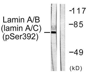 Lamin A/C (phospho-Ser392) antibody