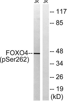 FoxO4 (phospho-Ser262) antibody