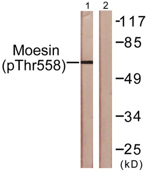 Moesin/Ezrin/Radixin (phospho-Thr558) antibody