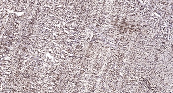 NFATc1 (phospho-Ser294) antibody