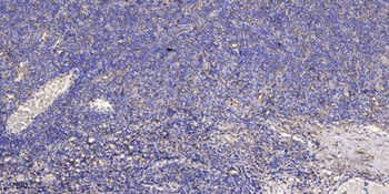 NFATc4 (phospho-Ser676) antibody