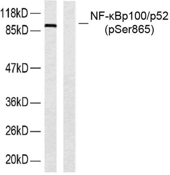 NF kappa B-p100 (phospho-Ser865) antibody