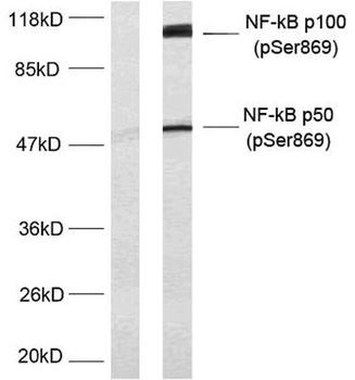 NF kappa B-p100 (phospho-Ser869) antibody