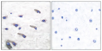 PDGFR-beta (phospho-Tyr751) antibody