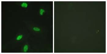 Rb (phospho-Thr821) antibody