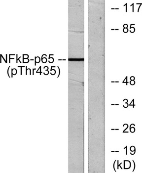 NF kappa B-p65 (phospho-Thr435) antibody