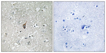 APC1 (phospho-Ser355) antibody