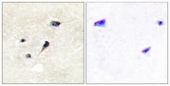 Synapsin I (phospho-Ser605) antibody