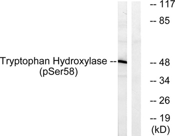 TPH1 (phospho-Ser58) antibody