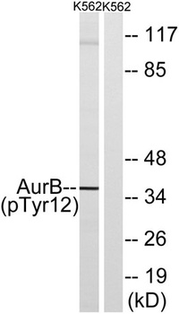 ARK-2 (phospho-Tyr12) antibody