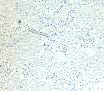 GAPDH antibody