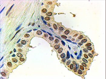 AR antibody