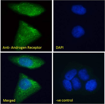 AR antibody