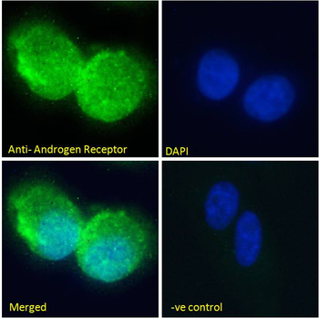 AR antibody