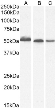 AKT3 antibody