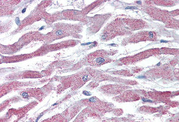 AKT3 antibody