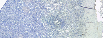 S100A9 antibody