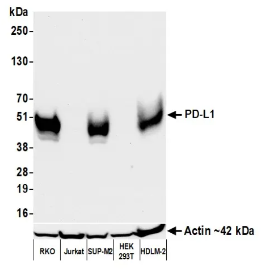Rabbit anti-PD-L1 Recombinant Monoclonal Antibody