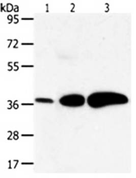 AKR1C1 Antibody