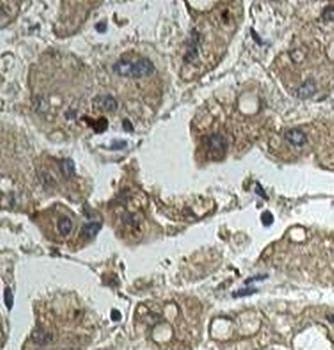 ALKBH1 antibody