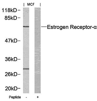 Estrogen Receptor-α (Ab67) Antibody