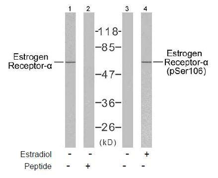 Estrogen Receptor-α (Phospho-Ser106) Antibody