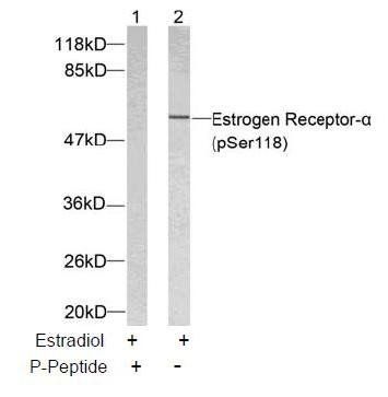 Estrogen Receptor-α (Phospho-Ser118) Antibody