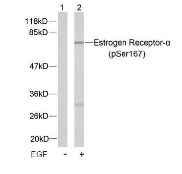 Estrogen Receptor-α (Phospho-Ser167) Antibody