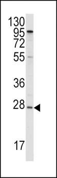 APOA1 antibody