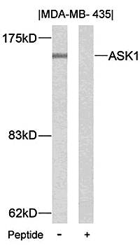 ASK1 (Ab-83) Antibody