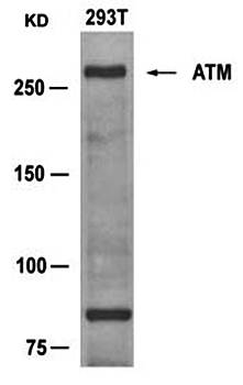 ATM (Ab981) Antibody