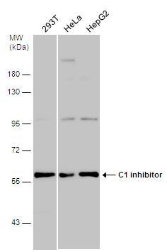 C1 inhibitor antibody