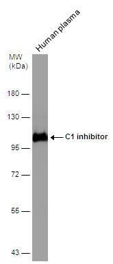 C1 inhibitor antibody