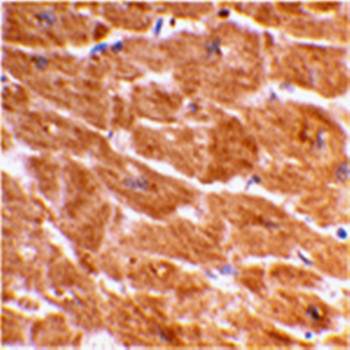 Caspase Antibody