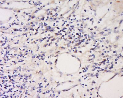 CD18 (Phospho-Ser756) antibody