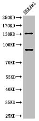 Cleaved-NOTCH2 (D1733) antibody