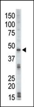 DRAK2 antibody