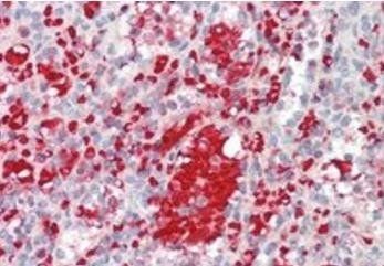 IGF1 Antibody