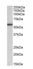TGFBR1 (aa50-63) Antibody