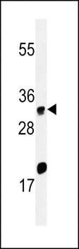 ELOVL5 antibody