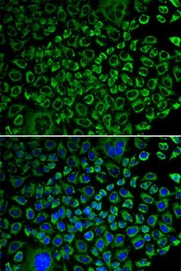 F10 antibody