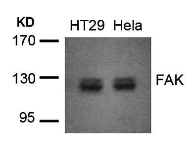 FAK (Ab-576/577) Antibody