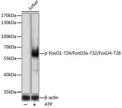FoxO1 (Phospho-T24/FoxO3a (Phospho-T32/FoxO4) antibody
