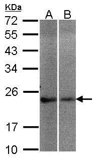 Frequenin antibody