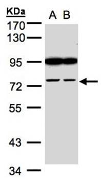 fibronectin type III and SPRY domain containing 2 antibody