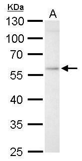 glucosylceramidase beta Antibody