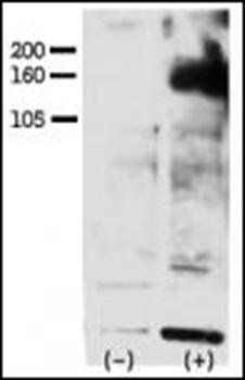 HER4 (phospho-Tyr1162) antibody