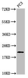 HIST1H1D (phospho-T146) antibody