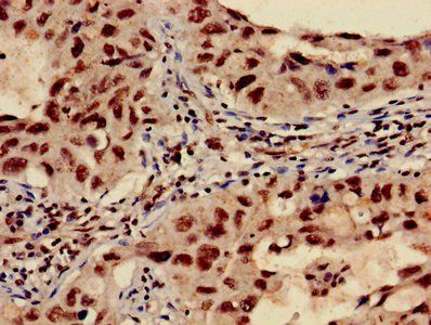 HIST1H3A (Ab-27) Antibody